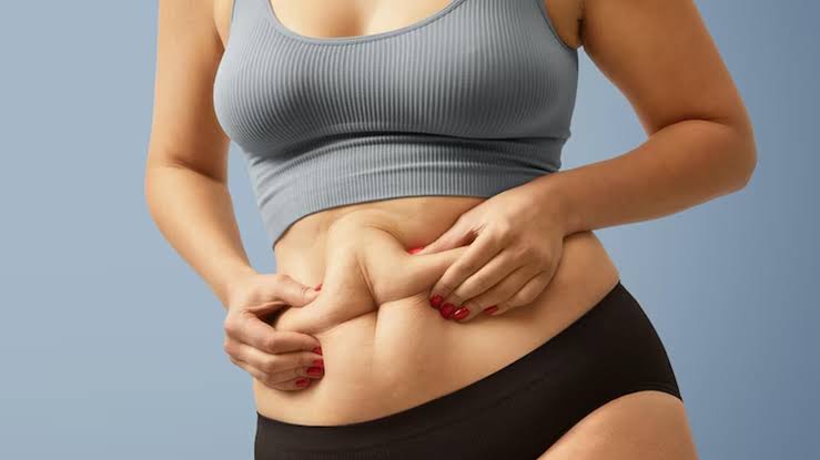 Why belly fat is more annoying than other fat